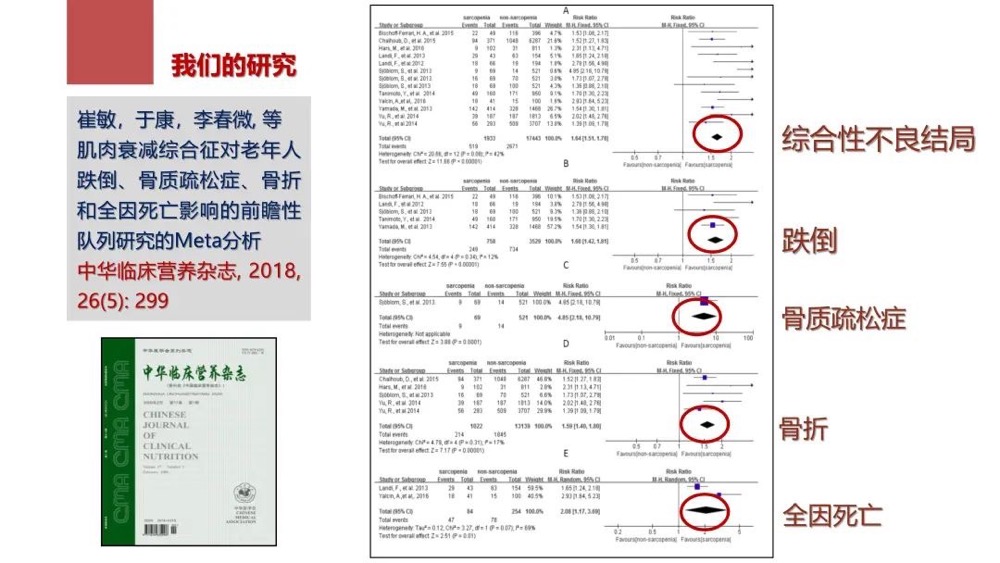 于康：肌肉衰减症临床诊疗及营养管理新进展(图3)